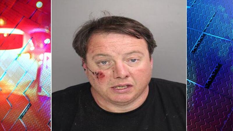 A Lowcountry man charged with setting his wife on fire has been released on a $100,000 bond.