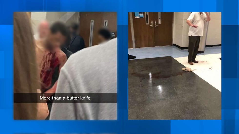 Videos and photos circulating on social media show a student with an apparent stab wound and...